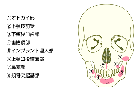 移植する骨